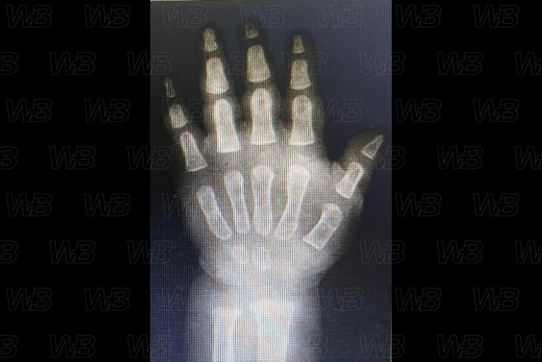 Texto alternativo para a imagem