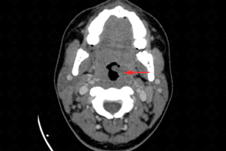 Texto alternativo para a imagem