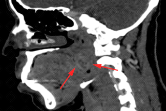 Texto alternativo para a imagem