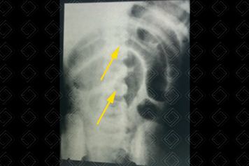 Texto alternativo para a imagem