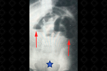 Texto alternativo para a imagem