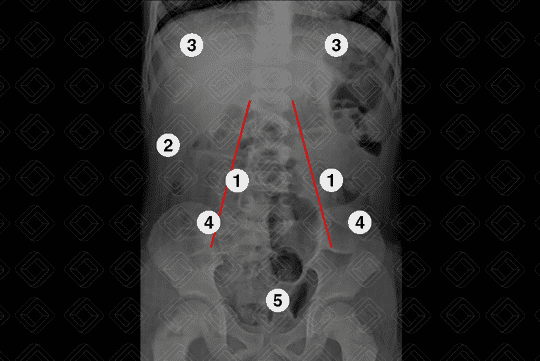 Texto alternativo para a imagem