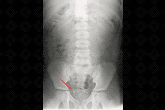 Texto alternativo para a imagem