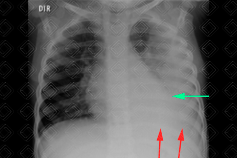 Texto alternativo para a imagem