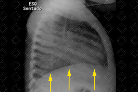Texto alternativo para a imagem