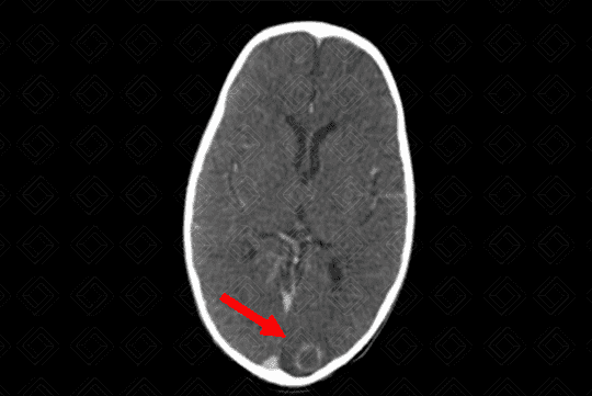 Texto alternativo para a imagem