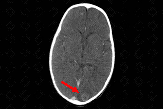 Texto alternativo para a imagem