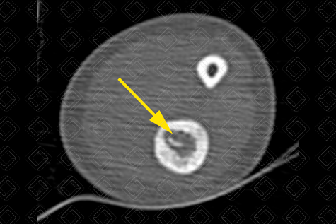 Texto alternativo para a imagem