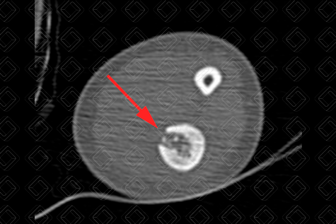 Texto alternativo para a imagem