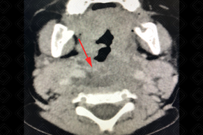 Texto alternativo para a imagem