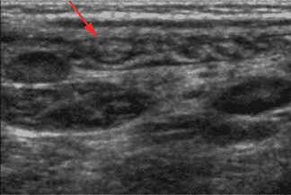 Texto alternativo para a imagem