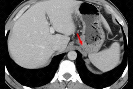 Texto alternativo para a imagem