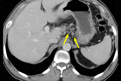 Texto alternativo para a imagem