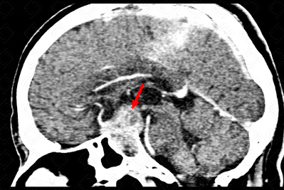 Texto alternativo para a imagem