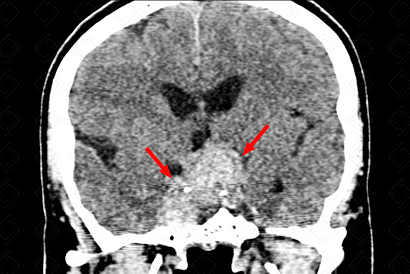 Texto alternativo para a imagem