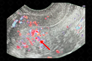 Texto alternativo para a imagem