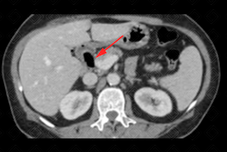 Texto alternativo para a imagem