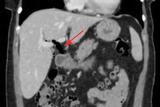 Texto alternativo para a imagem