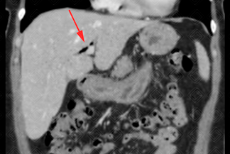 Texto alternativo para a imagem