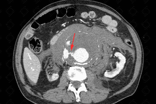 Texto alternativo para a imagem