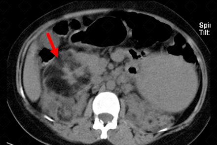 Texto alternativo para a imagem