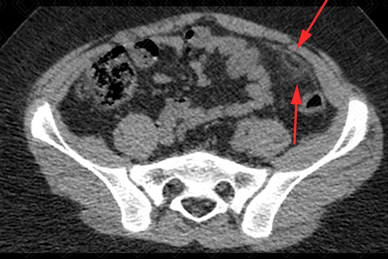 Texto alternativo para a imagem