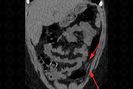 Texto alternativo para a imagem