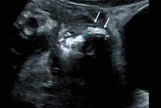 Texto alternativo para a imagem