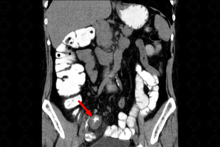 Texto alternativo para a imagem