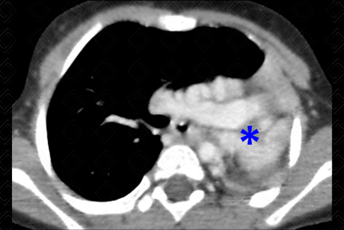 Texto alternativo para a imagem