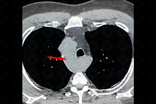 Texto alternativo para a imagem