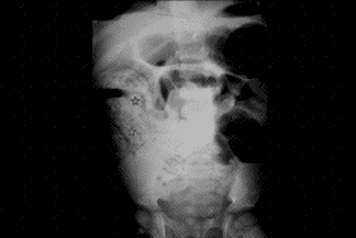 Texto alternativo para a imagem