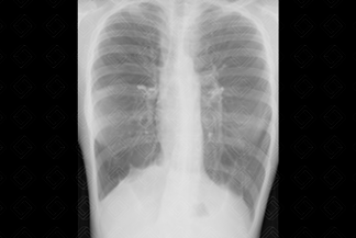 Texto alternativo para a imagem