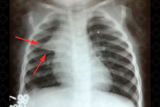 Texto alternativo para a imagem