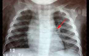 Texto alternativo para a imagem