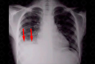 Texto alternativo para a imagem