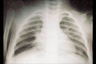 Texto alternativo para a imagem