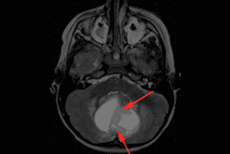 Texto alternativo para a imagem