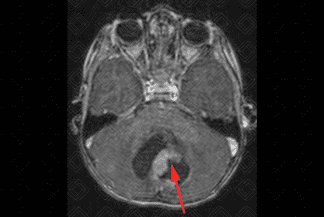 Texto alternativo para a imagem