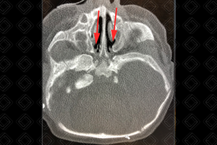 Texto alternativo para a imagem