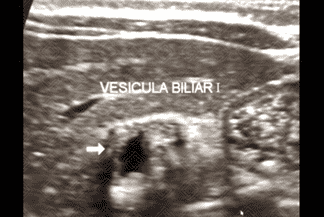 Texto alternativo para a imagem