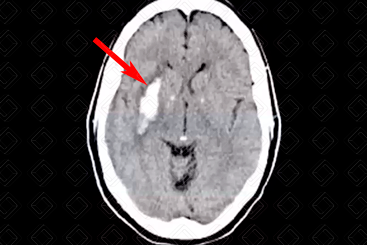 Texto alternativo para a imagem