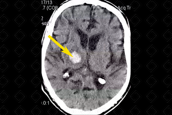 Texto alternativo para a imagem