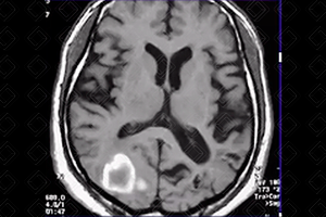 Texto alternativo para a imagem