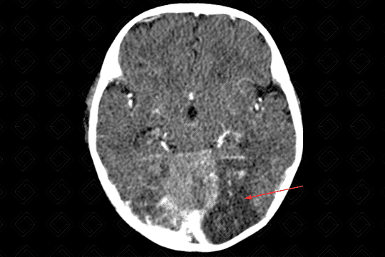 Texto alternativo para a imagem