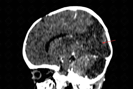 Texto alternativo para a imagem