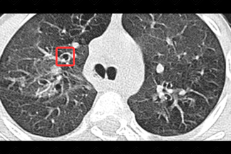 Texto alternativo para a imagem