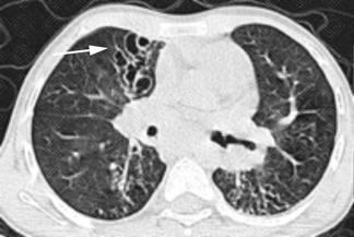 Texto alternativo para a imagem