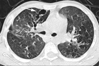 Texto alternativo para a imagem