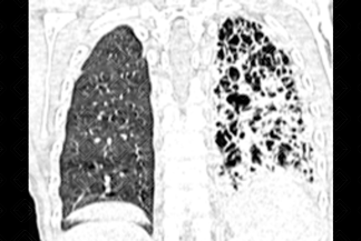 Texto alternativo para a imagem